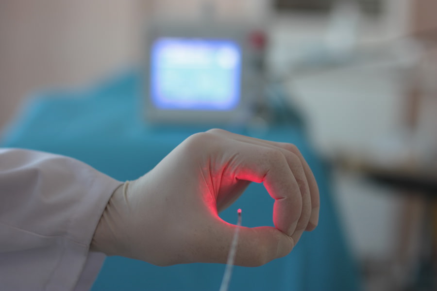 Лазерное иссечение хронической анальной трещины в Симферополе | Медцентр Авиценна